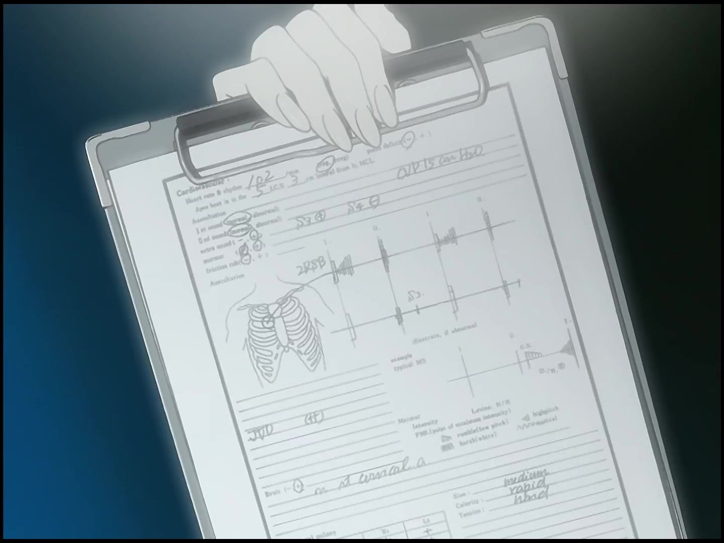 [Tsukyio Editing Resources] FLCL (Episode 1) Raw Clips (145) (tsukyio.com).mp4